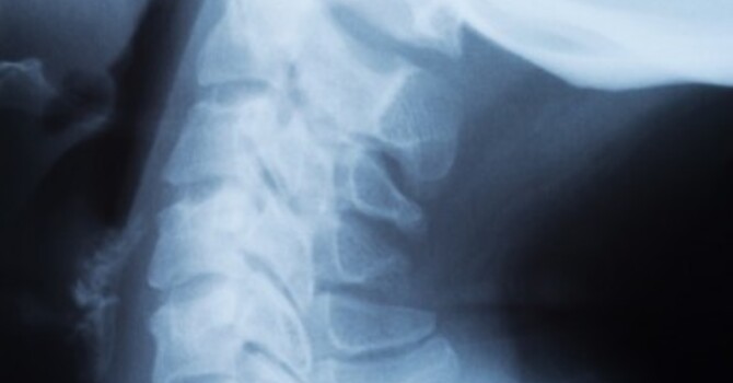 TYPICAL CERVICAL PROBLEMS TREATED BY CHIROPRACTIC